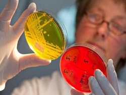 Ученые из Перми "побороли" одну из самых опасных бактерий